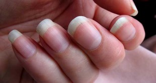 Health WARNINGS Your Fingernails May Be Showing You