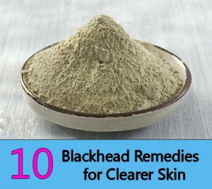 Blackhead Treatments: 10 Simple Home Remedies for Clearer Skin - Home ...