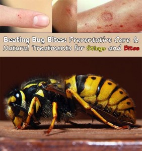 Beating Bug Bites: Preventative Care and Natural Treatments for Stings ...