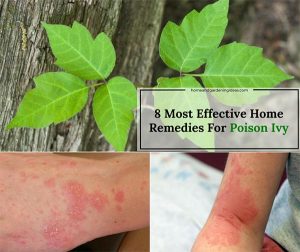 Poison Ivy Home Remedies: 8 Most Effective Remedies For Poison Ivy ...